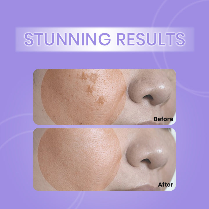Dark Spot Repair Lotion